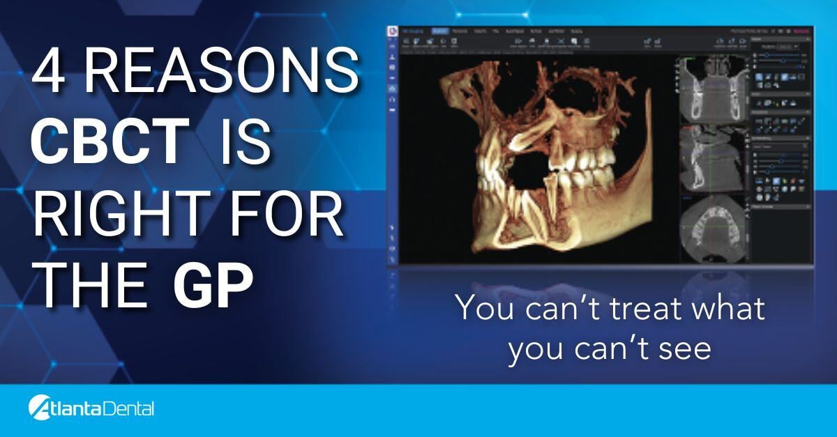 4 Reasons CBCT is right for the GP  article cover image