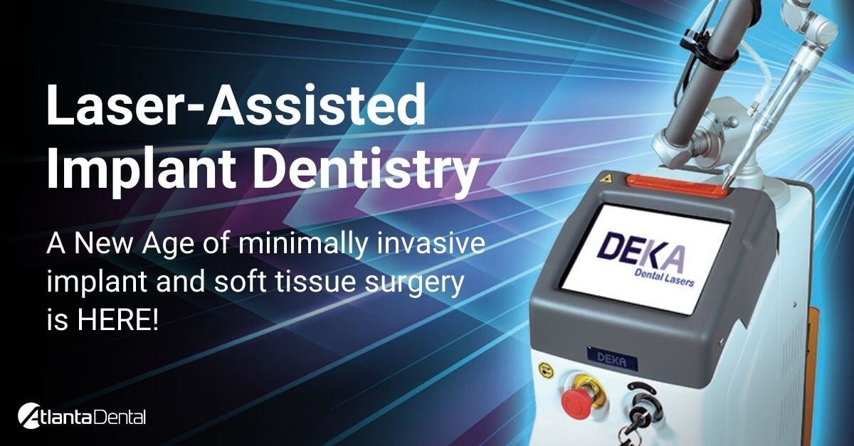 Laser-Assisted Implant Dentistry article cover image