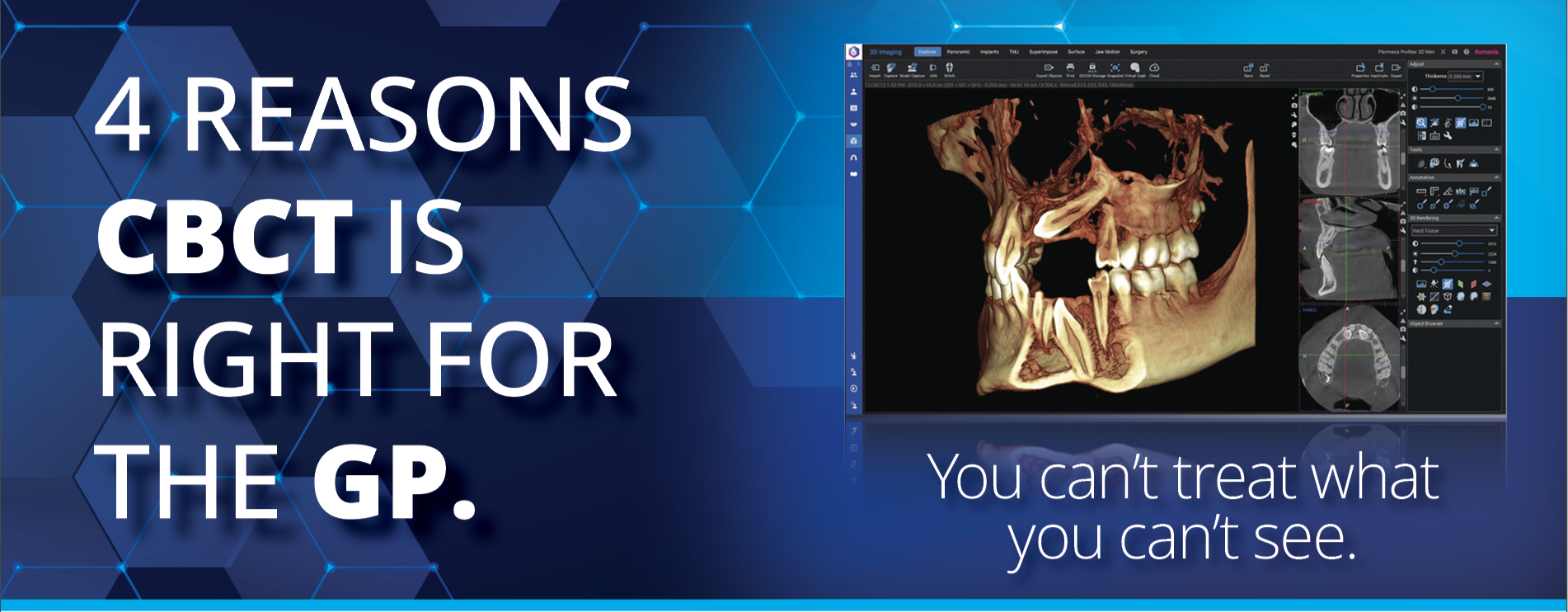 Title & CBCT Image